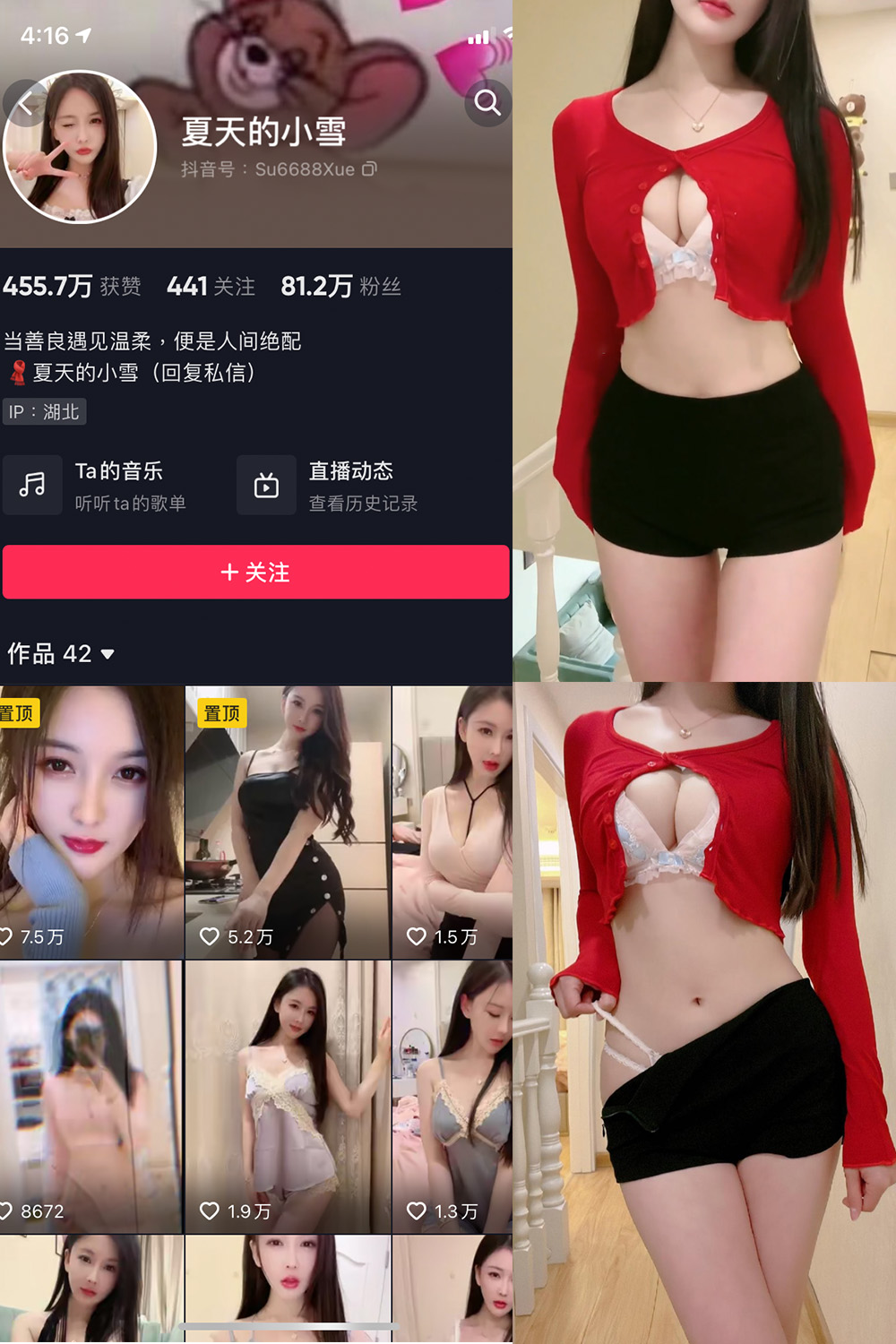 抖音 夏天的小雪 微密圈  NO.006期 【3V】-优选资源网